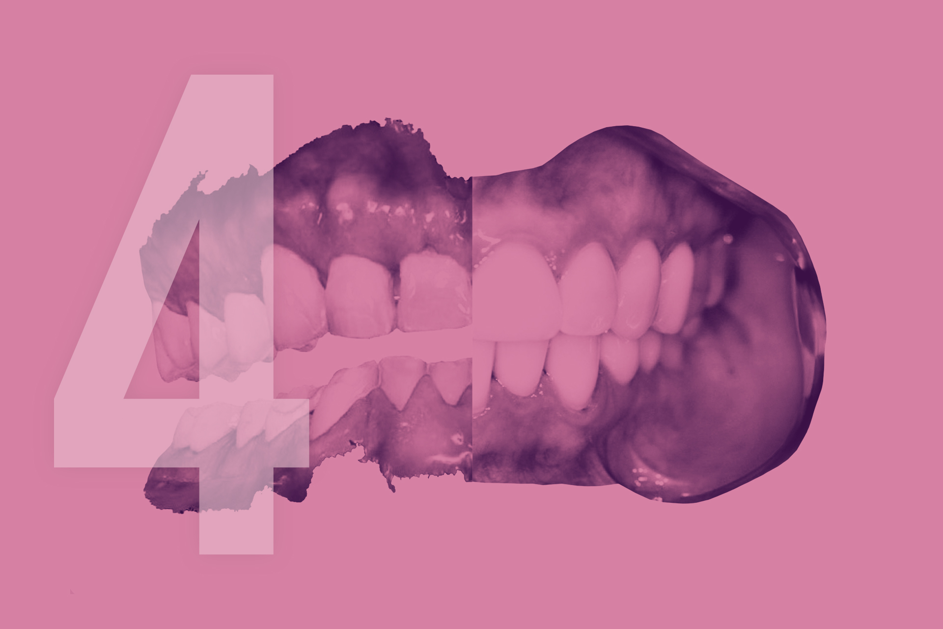 module-4-grandes-reconstructions-college-occlusodontie-cno-aquitaine