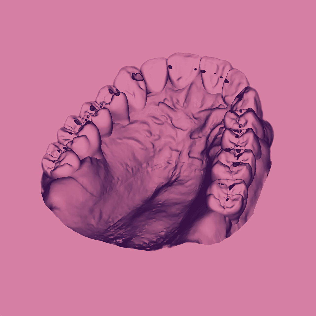 octa-digital-concept-conference-college-occlusodontie-cno-aquitaine-carre