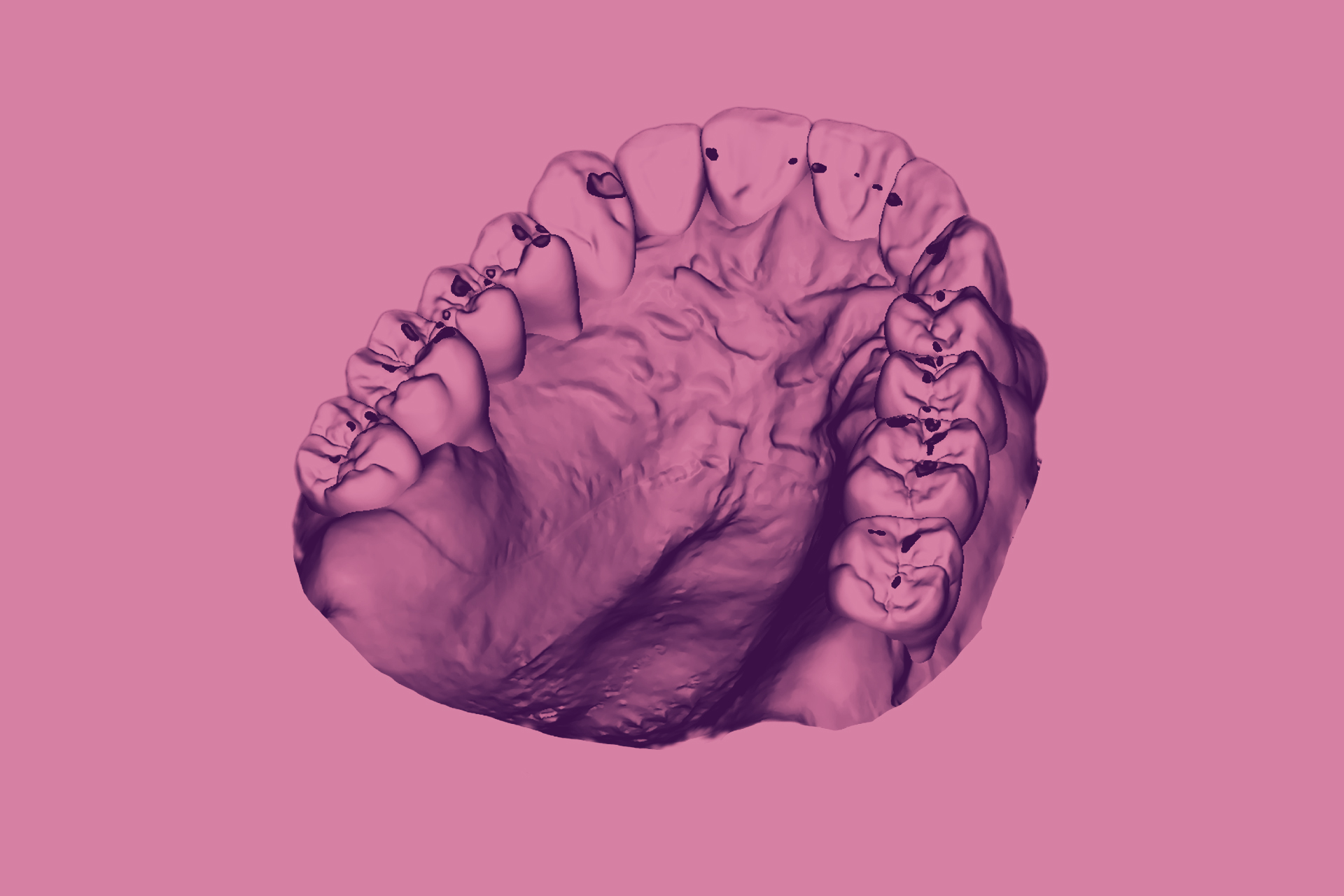 octa-digital-concept-conference-college-occlusodontie-cno-aquitaine