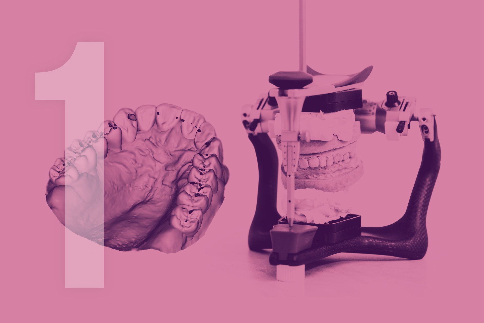 module-1-place-de-larticulateur-dans-le-plan-de-traitement-college-occlusodontie-cno-aquitaine